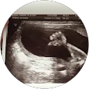 Mummytobe 2017